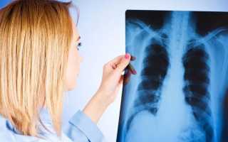 Легочное кровотечение – причины патологии