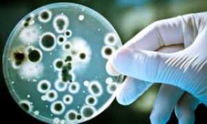 Лечение молочницы спринцеванием лекарственной ромашкой