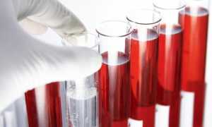 Генитальный герпес у детей