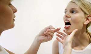 Таблетки при ларингите у взрослых — обзор эффективных препаратов с инструкцией и ценой