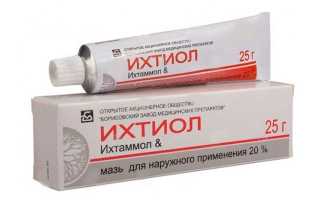 Мазь при ячмене на глазу — список лучших препаратов с описанием состава, инструкцией по применению и ценами