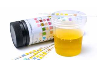 Сахар в моче — норма у мужчин и женщин, причины повышенных значений и как правильно сдавать анализ