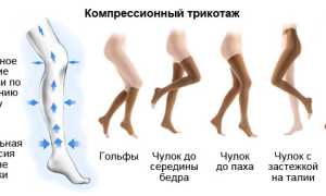 Как выбрать компрессионные чулки для родов, полезные советы