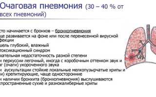 Внебольничная пневмония у детей и взрослых — клинические рекомендации