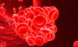 Артериальный тромбоз – причины и предрасполагающие факторы, диагностика и методы лечения