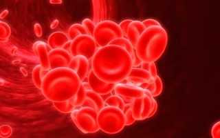 Артериальный тромбоз – причины и предрасполагающие факторы, диагностика и методы лечения