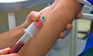 Анализ крови на СОЭ — показания к проведению, показатели нормы