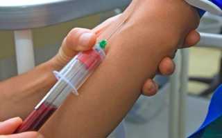 Анализ крови на СОЭ — показания к проведению, показатели нормы