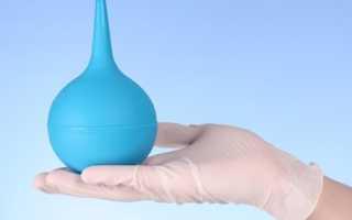 Лечение молочницы при помощи спринцевания