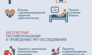 МРТ головного мозга: показания к исследованию