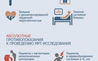 МРТ головного мозга: показания к исследованию