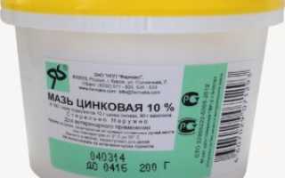 Свойства и преимущества цинковой мази при лечении псориаза