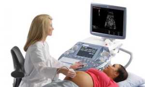 Доплерометрия для беременных