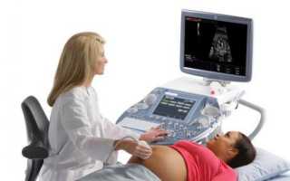 Доплерометрия для беременных