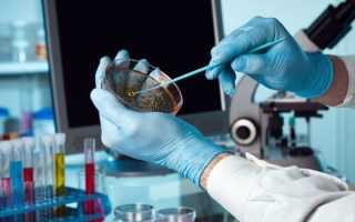 Анализ кала на копрограмму — когда назначают и как проводят