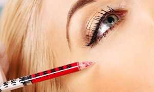 Плазмолифтинг