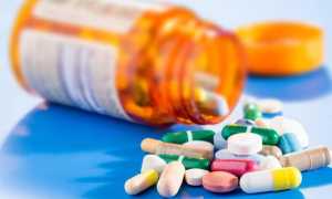 Радикулопатия – что это за заболевание, причины, симптомы и виды, диагностика, методы терапии и профилактика