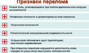 Перелом шейки бедра — симптомы травмы сустава