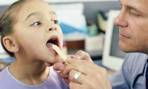 Что такое аденоидит? Выбираем метод лечения