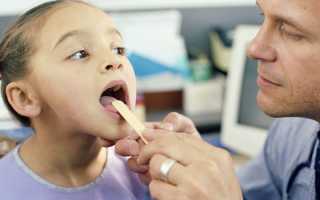 Что такое аденоидит? Выбираем метод лечения