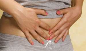 Дивертикулит — причины возникновения, симптомы, диагностика, медикаментозное и хирургическое лечение