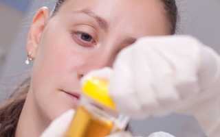 Белок в моче при беременности – диагностика, лечение и профилактика