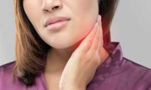 Лимфаденит — лечение и симптомы