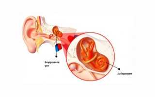 Хронический отит у взрослого и ребенка — симптомы и лечение
