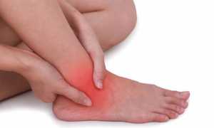 Лечение вывиха стопы в домашних условиях — препараты, народные методы