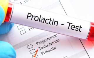 Пролактин у мужчин — норма и причины отклонения, нормализация значений