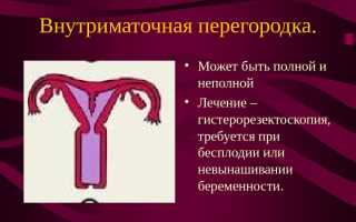 Почему образуется перегородка в матке и нужно ли ее удалять?