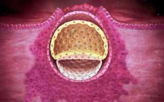 Кровотечение после переноса эмбрионов: почему и что делать?