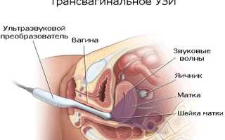 В каких случаях необходимо делать УЗИ на овуляцию?