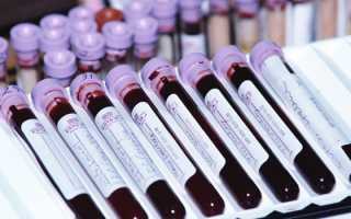 Щелочная фосфатаза — нормальный уровень в биохимическом анализе крови у детей и взрослых