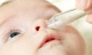 Причины появления молочницы у маленьких деток