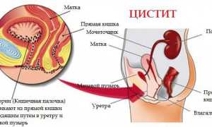 Фуросемид: инструкция по применению, цена, отзывы