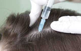 Выпадают волосы — что делать