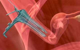 Больно ли делать ЭКО: отзывы, пункция и перенос