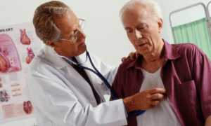 Лечение мерцательной аритмии сердца