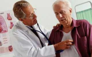 Лечение мерцательной аритмии сердца