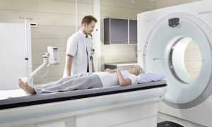 Некроз тканей – что это такое, причины и симптомы, диагностика, методы лечения и возможные последствия