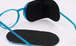 Окклюдер — как выбрать для ребенка или взрослого, особенности использования и ухода