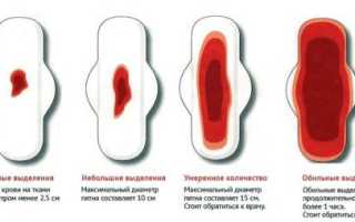 Какие выделения после биопсии шейки матки опасны?