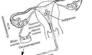 Поздняя имплантация эмбриона и ХГЧ при ЭКО