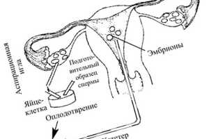 Поздняя имплантация эмбриона и ХГЧ при ЭКО