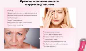 Как убрать мешки под глазами, причины и лечение отеков