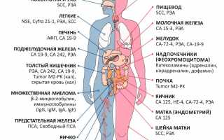 Урология анализ на онкомаркеры