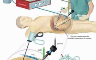 Оперативные вмешательства в урологии
