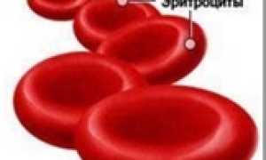 Эритроциты в моче