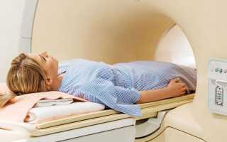 Особенности диеты при лучевой терапии после удаления матки